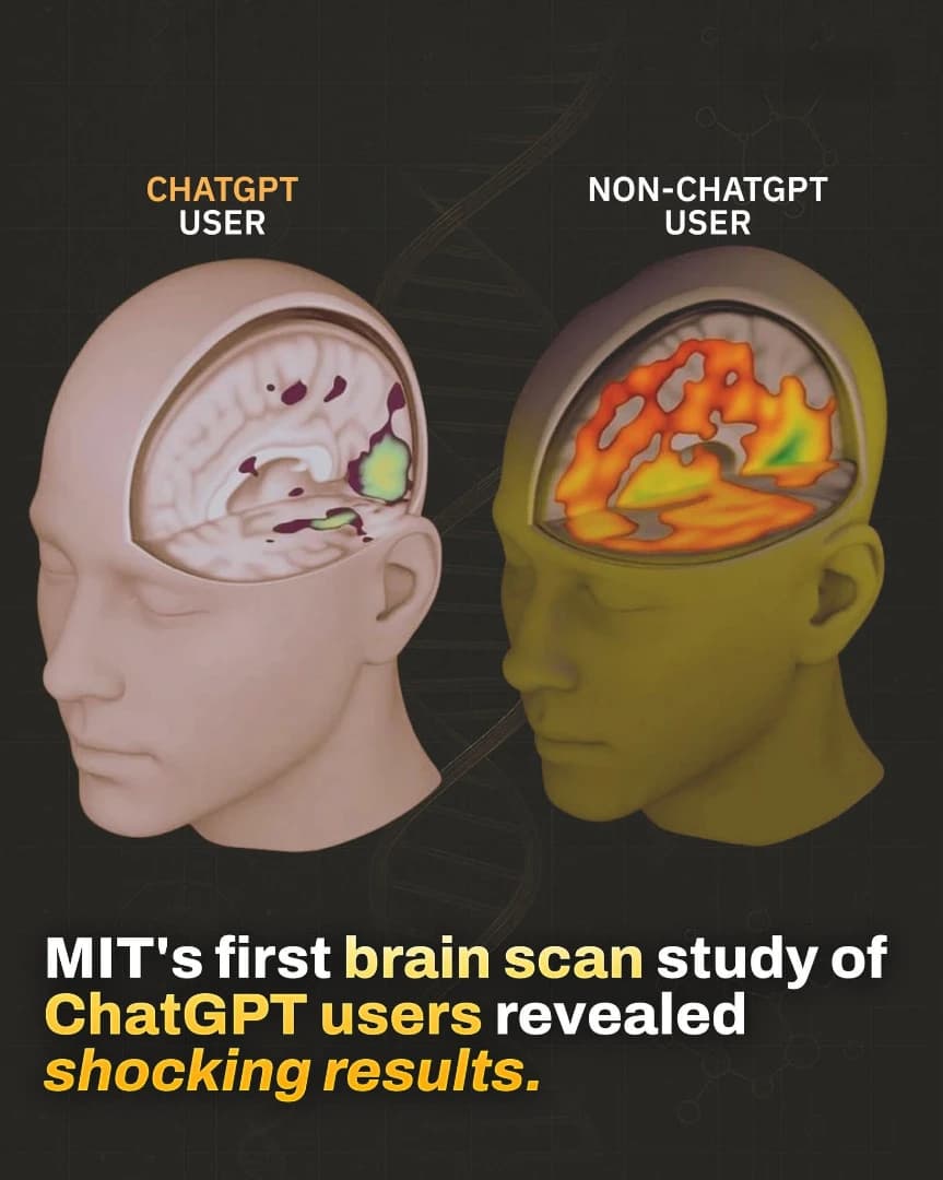 ఏఐ మన మెదడును నిద్రపుచ్చుతుందా? — ఎంఐటీ EEG అధ్యయనం & జింబాబ్వే కేస్ స్టడీ సారాంశం